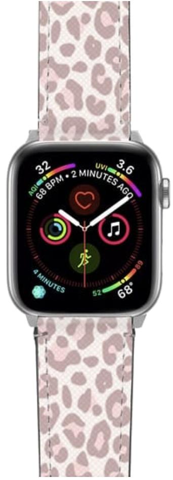 CASETiFY Apple Watch Band 