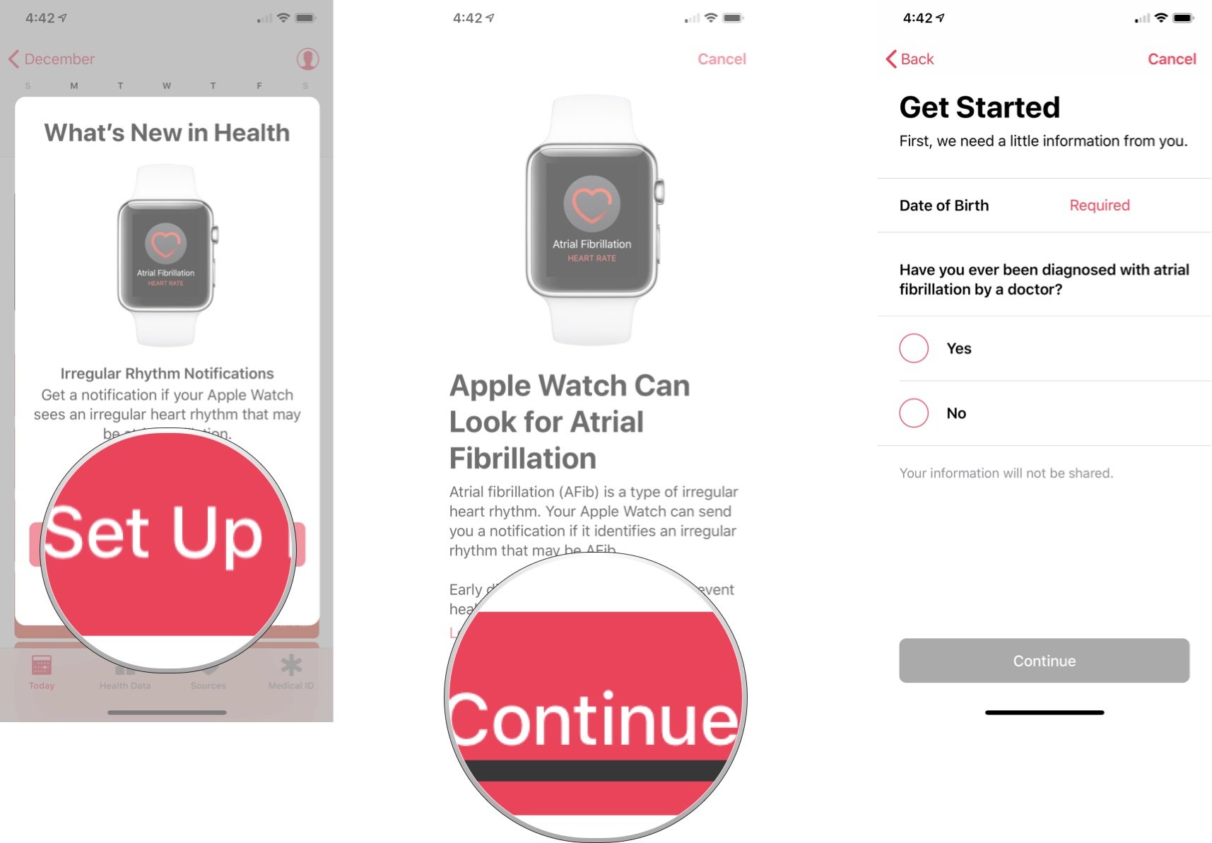 To set up and use the irregular rhythm notification on Apple Watch, tap Set Up Notifications, then selection Continue. Enter your birthday, then tap Continue."
