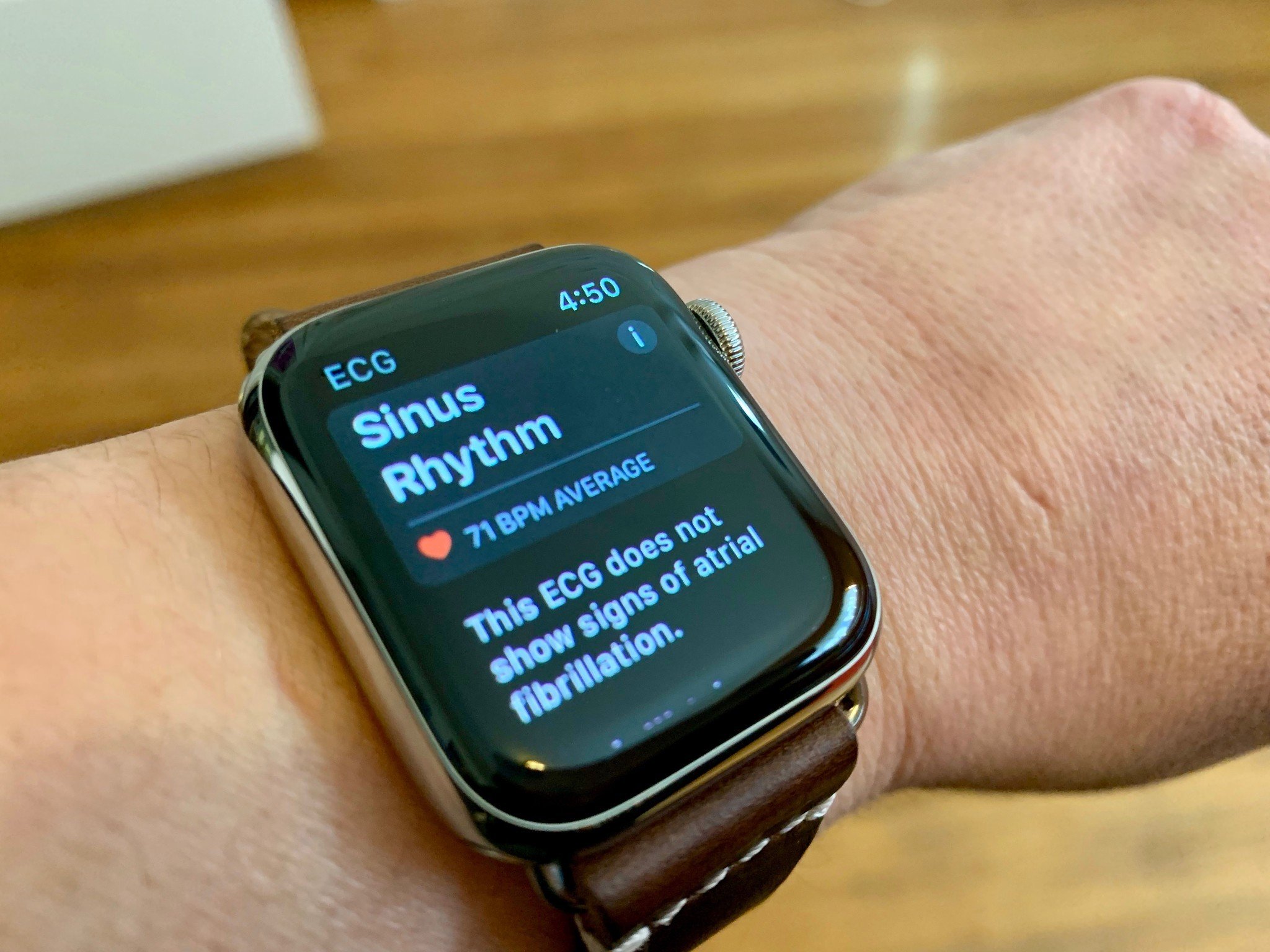 ECG results on Apple Watch Series 4