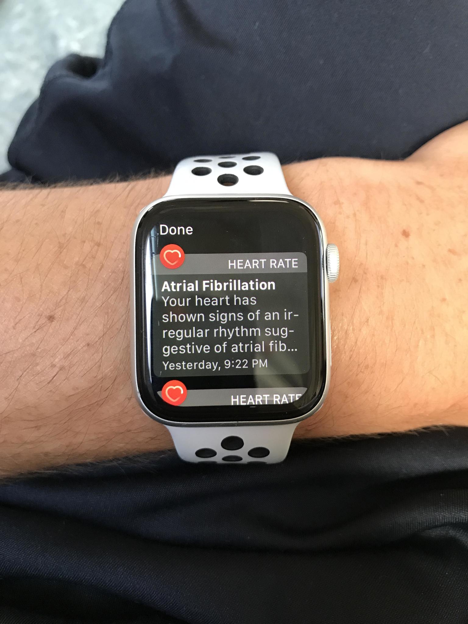 Apple Watch Afib Notification
