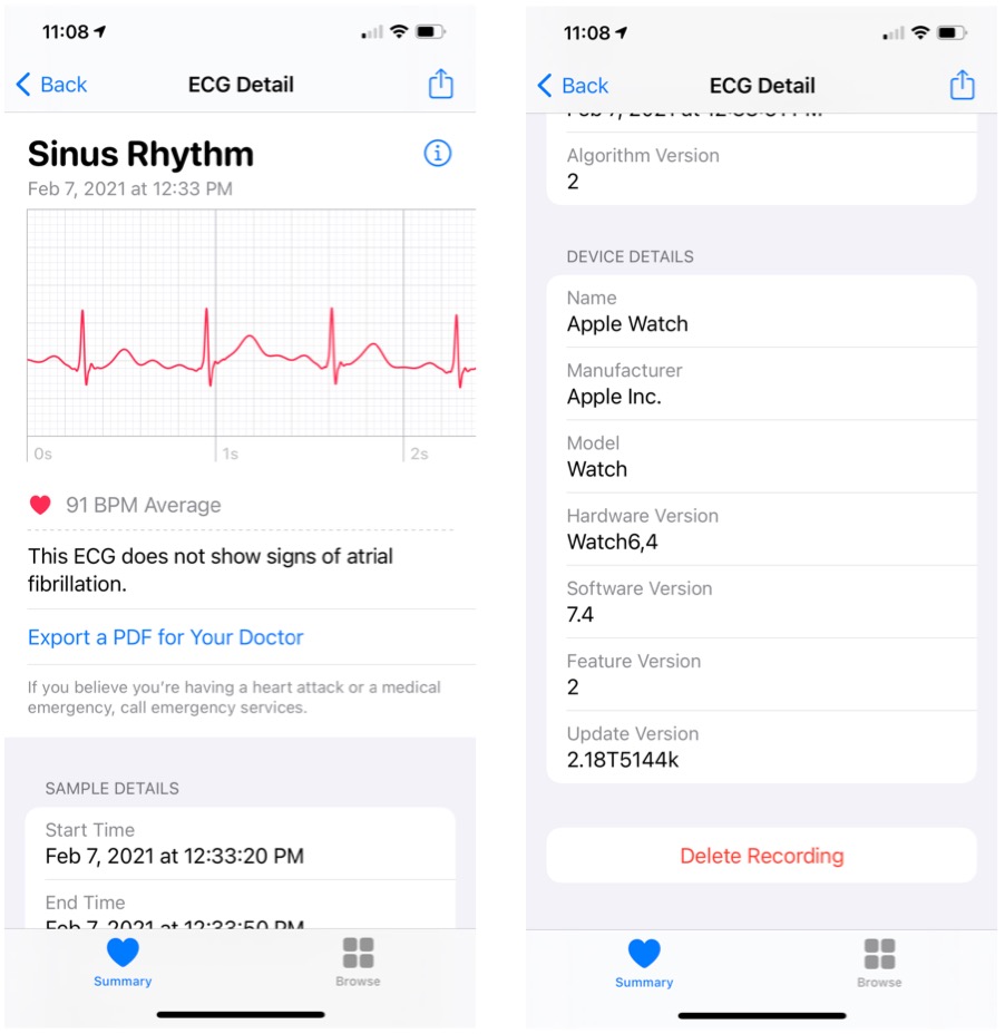 to view ECG data on the Health app for iPhone, choose one of the readings, then scroll down for more information.