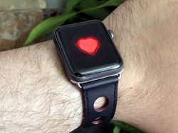 Apple Watch may have saved another life