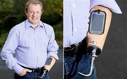 Man uses prosthetic arm as a smartphone holder