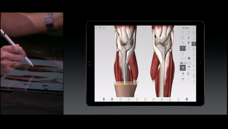 3D 4 Medical leverages the iPad Pro to let doctors explain injuries to patients